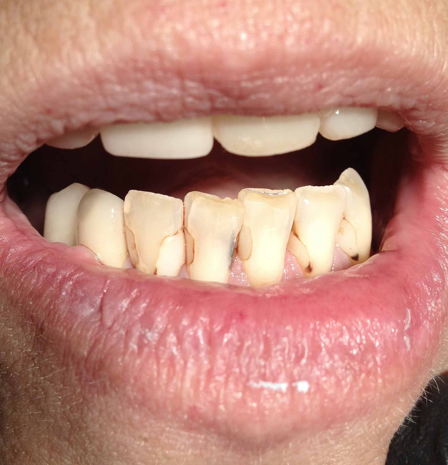 Colorado Springs Dentist Tuttle Family Dentistry